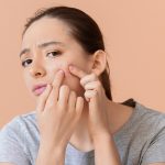 Salicylic acid for skin