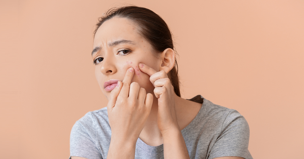 Salicylic acid for skin